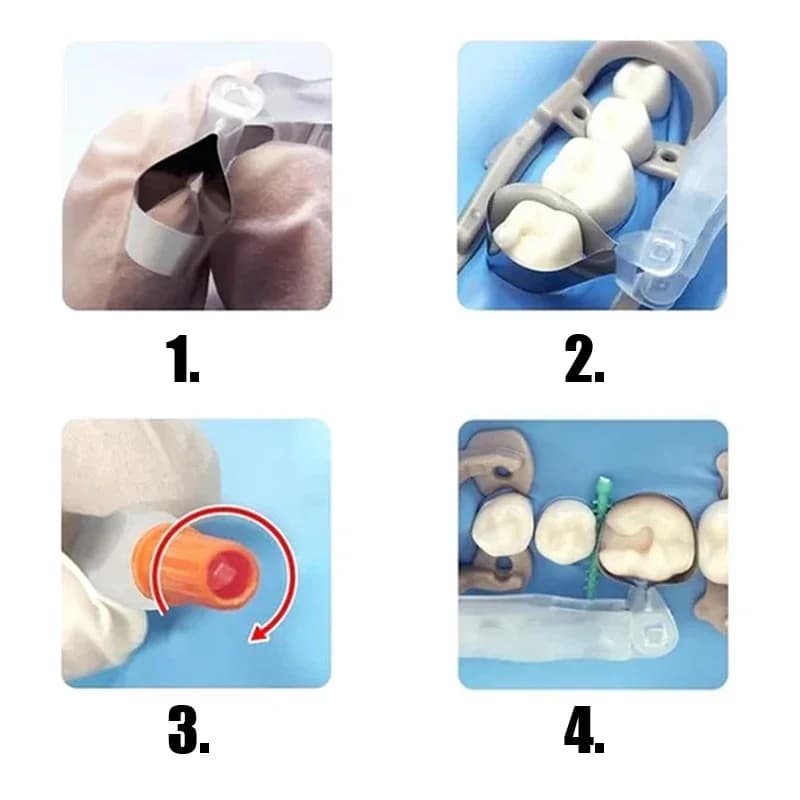 10/24pcs Dental Pro Matrix Bands 180° Adjustable Sectional Matrix Bands Holder Tooth Pre-Formed Dental Crown Materials Dentistry - image 6