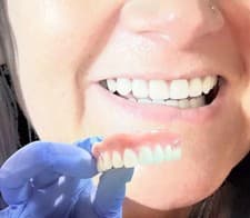 DIY Full Denture Kit Make Your Own Teeth At Home Affordable Missing Tooth USA - image 2